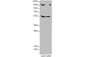 Western blot All lanes: CSPP1 antibody at 1. (CSPP1 抗体  (AA 997-1256))