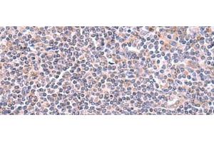Immunohistochemistry of paraffin-embedded Human tonsil tissue using GMDS Polyclonal Antibody at dilution of 1:70(x200) (GMDS 抗体)