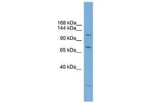 WB Suggested Anti-PAntibody Titration:  0. (PARP10 抗体  (N-Term))