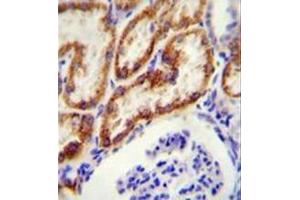 Immunohistochemistry analysis in formalin fixed and paraffin embedded human kidney tissue reacted with Glycine amidinotransferase antibody (N-term) followed by peroxidase conjugation of the secondary antibody and DAB staining. (GATM 抗体  (N-Term))