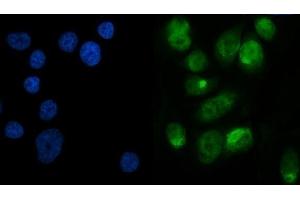 IF analysis of METTL3 using anti-METTL3 antibody (ABIN7602366).