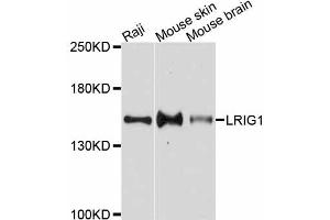 Western blot analysis of extracts of various cell lines, using LRIG1 antibody. (Lrig1 抗体)