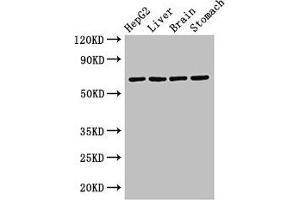 Western Blot Positive WB detected in: HepG2 whole cell lysate, Rat liver tissue, Rat brain tissue, Rat stomach tissue All lanes: RCBTB2 antibody at 3. (RCBTB2 抗体  (AA 1-200))