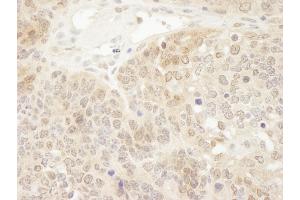 Immunohistochemistry (IHC) image for anti-Parkinson Protein 7 (PARK7) (C-Term) antibody (ABIN7448532) (PARK7/DJ1 抗体  (C-Term))
