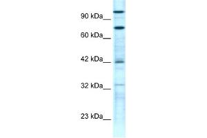 WB Suggested Anti-ZNF23 Antibody Titration:  0. (ZNF23 抗体  (N-Term))