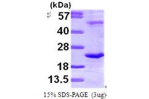 SDS-PAGE (SDS) image for TATA-Binding Protein-Associated Phosphoprotein (DR1) (AA 1-176) protein (His tag) (ABIN667179) (DR1 Protein (AA 1-176) (His tag))