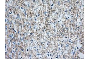 Immunohistochemical staining of paraffin-embedded Human liver tissue using anti-HIBCH mouse monoclonal antibody. (HIBCH 抗体)