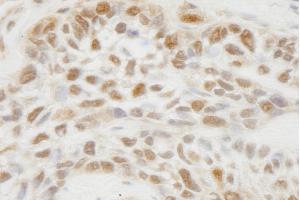 anti-Jumonji Domain Containing 1C (JMJD1C) (AA 150-200) antibody