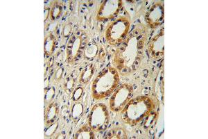 CYP27B1 Antibody (C-term) B immunohistochemistry analysis in formalin fixed and paraffin embedded human kidney tissue followed by peroxidase conjugation of the secondary antibody and DAB staining. (CYP27B1 抗体  (C-Term))