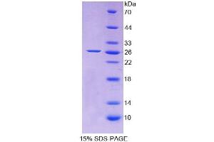 SDS-PAGE analysis of Rat Apolipoprotein A5 Protein. (APOA5 蛋白)