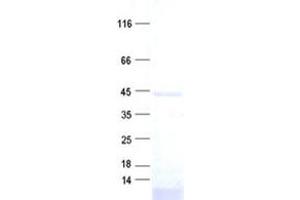 Western Blotting (WB) image for DENN/MADD Domain Containing 1B (DENND1B) protein (His tag) (ABIN2719383)
