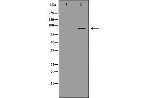 Western blot analysis of extracts from Jurkat cells, using DVL2 antibody. (DVL2 抗体  (C-Term))