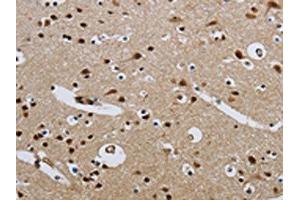 The image on the left is immunohistochemistry of paraffin-embedded Human brain tissue using ABIN7190315(CMTM8 Antibody) at dilution 1/40, on the right is treated with synthetic peptide. (CMTM8 抗体)