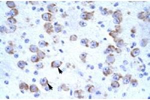 Immunohistochemical staining (Formalin-fixed paraffin-embedded sections) of human brain with CATSPER2 polyclonal antibody  at 4-8 ug/mL working concentration. (CATSPER2 抗体  (N-Term))