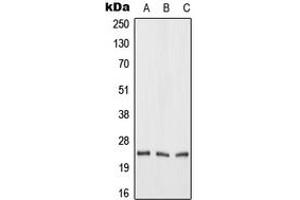 Western blot analysis of FGF19 expression in HeLa (A), mouse liver (B), rat liver (C) whole cell lysates. (FGF19 抗体  (Center))