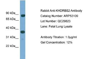 WB Suggested Anti-KHDRBS2  Antibody Titration: 0. (KHDRBS2 抗体  (N-Term))