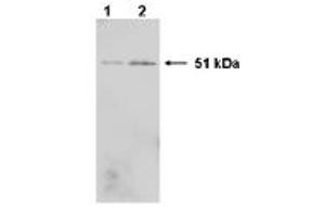 Western Blotting (WB) image for anti-Heterogeneous Nuclear Ribonucleoprotein K (HNRNPK) (C-Term) antibody (ABIN264512) (HNRNPK 抗体  (C-Term))