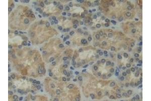 Detection of ITGaD in Human Kidney Tissue using Polyclonal Antibody to Integrin Alpha D (ITGaD)