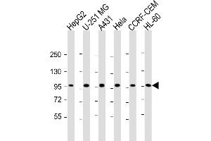 All lanes : Anti-TAF4 Antibody (C-Term) at 1:2000 dilution Lane 1: HepG2 whole cell lysate Lane 2: U-251 MG whole cell lysate Lane 3: A431 whole cell lysate Lane 4: Hela whole cell lysate Lane 5: CCRF-CEM whole cell lysate Lane 6: HL-60 whole cell lysate Lysates/proteins at 20 μg per lane. (TAF4 抗体  (AA 1021-1062))