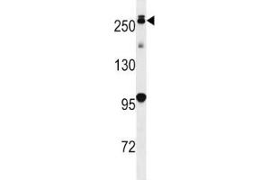 PARK8 antibody western blot analysis in mouse lung tissue lysate. (LRRK2 抗体  (AA 930-961))