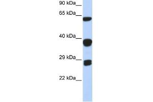 SNRPB antibody used at 1 ug/ml to detect target protein. (SNRPB 抗体  (Middle Region))