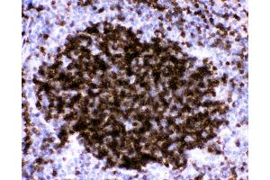 Immunohistochemistry (IHC) image for anti-Fc Fragment of IgE, Low Affinity II, Receptor For (CD23) (FCER2) (AA 50-331) antibody (ABIN3043829)