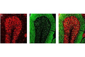 Coronal sections of rat cerebellum, stained with human patient autoantibodies (E, red) and anti-vGlut1 (F, green labeling, Cat no (ABIN1305045), 1:300).