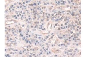 Immunohistochemistry (IHC) image for anti-Coactosin-Like Protein (AA 1-142) antibody (ABIN7436669)
