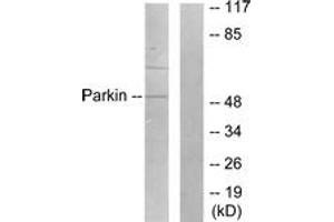 Western blot analysis of extracts from Jurkat cells, using Parkin Antibody. (Parkin 抗体  (AA 1-50))