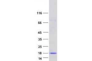 C2orf88 Protein (Transcript Variant 3) (Myc-DYKDDDDK Tag)