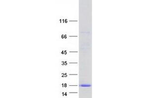 C2orf88 Protein (Transcript Variant 3) (Myc-DYKDDDDK Tag)
