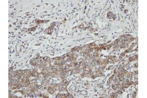 IHC-P Image Immunohistochemical analysis of paraffin-embedded N87 xenograft, using PON2, antibody at 1:100 dilution. (PON2 抗体)