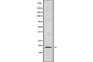 Western blot analysis of RPL24 using LOVO whole cell lysates (RPL24 抗体  (Internal Region))