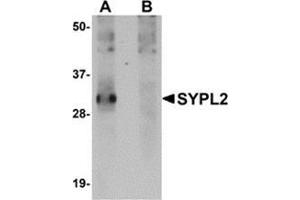 Western blot analysis of SYPL2 in human spleen tissue lysate with this product at 1 μg/ml in (A) the absence and (B) the presence of blocking peptide. (SYPL2 抗体  (C-Term))