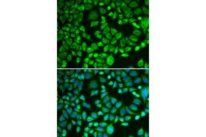 Immunofluorescence analysis of MCF-7 cells using PSMD7 antibody. (PSMD7 抗体)