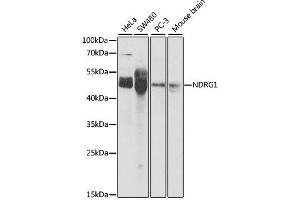 Western blot analysis of extracts of various cell lines, using NDRG1 antibody. (NDRG1 抗体  (AA 175-394))