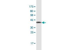 Western Blot detection against Immunogen (43. (ANKRD37 抗体  (AA 1-158))