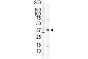 Western Blotting (WB) image for anti-Calcium/calmodulin-Dependent Protein Kinase I (CAMK1) antibody (ABIN3003045) (CAMK1 抗体)