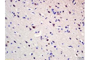 Formalin-fixed and paraffin embedded rat brain labeled with Rabbit Anti-Pumilio 1 Polyclonal Antibody, Unconjugated (ABIN1387238) at 1:200 followed by conjugation to the secondary antibody and DAB staining (PUM1 抗体  (AA 201-300))
