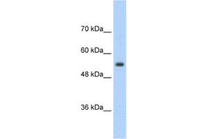Western Blotting (WB) image for anti-Solute Carrier Family 13 Member 3 (SLC13A3) antibody (ABIN2462409) (SLC13A3 抗体)