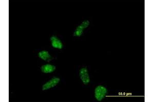 Immunofluorescence of purified MaxPab antibody to GTF2B on HeLa cell. (GTF2B 抗体  (AA 1-316))