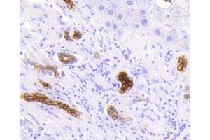Paraformaldehyde-fixed, paraffin embedded Human liver, Antigen retrieval by boiling in sodium citrate buffer (pH6) for 15min, Block endogenous peroxidase by 3% hydrogen peroxide for 30 minutes, Blocking buffer at 37°C for 20min, Antibody incubation with Cytokeratin 19 (2F3) Monoclonal Antibody  at 1:50 overnight at 4°C, followed by a conjugated secondary and DAB staining. (Cytokeratin 19 抗体)