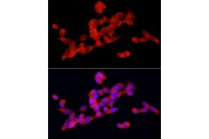 Immunofluorescence analysis of SH-SY5Y cells using DOK4 Rabbit pAb (ABIN3020721, ABIN3020722, ABIN3020723 and ABIN6213691) at dilution of 1:50 (40x lens).