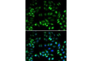 Immunofluorescence analysis of U2OS cells using MANF antibody. (MANF 抗体  (AA 25-182))