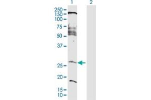 Western Blot analysis of FAM177A1 expression in transfected 293T cell line by FAM177A1 MaxPab polyclonal antibody. (FAM177A1 抗体  (AA 1-213))
