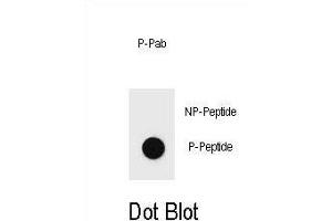 Dot blot analysis of Phospho-BAD-Y76 Antibody Phospho-specific Pab j on nitrocellulose membrane. (BAD 抗体  (pTyr76))