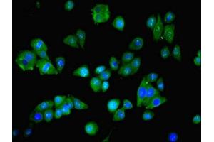 Immunofluorescent analysis of HepG2 cells using ABIN7144725 at dilution of 1:100 and Alexa Fluor 488-congugated AffiniPure Goat Anti-Rabbit IgG(H+L) (NARS 抗体  (AA 1-300))