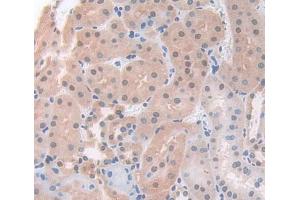 IHC-P analysis of Kidney tissue, with DAB staining. (ACD 抗体  (AA 21-175))