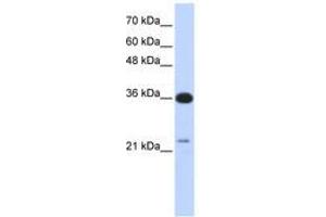 Image no. 1 for anti-TP53 Target 5 (TP53TG5) (AA 143-192) antibody (ABIN6741254) (TP53TG5 抗体  (AA 143-192))