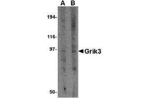 Western blot analysis of Grik3 in human brain tissue lysate with AP30383PU-N Grik3 antibody at (A) 1 and (B) 2 μg/ml. (GRIK3 抗体  (N-Term))